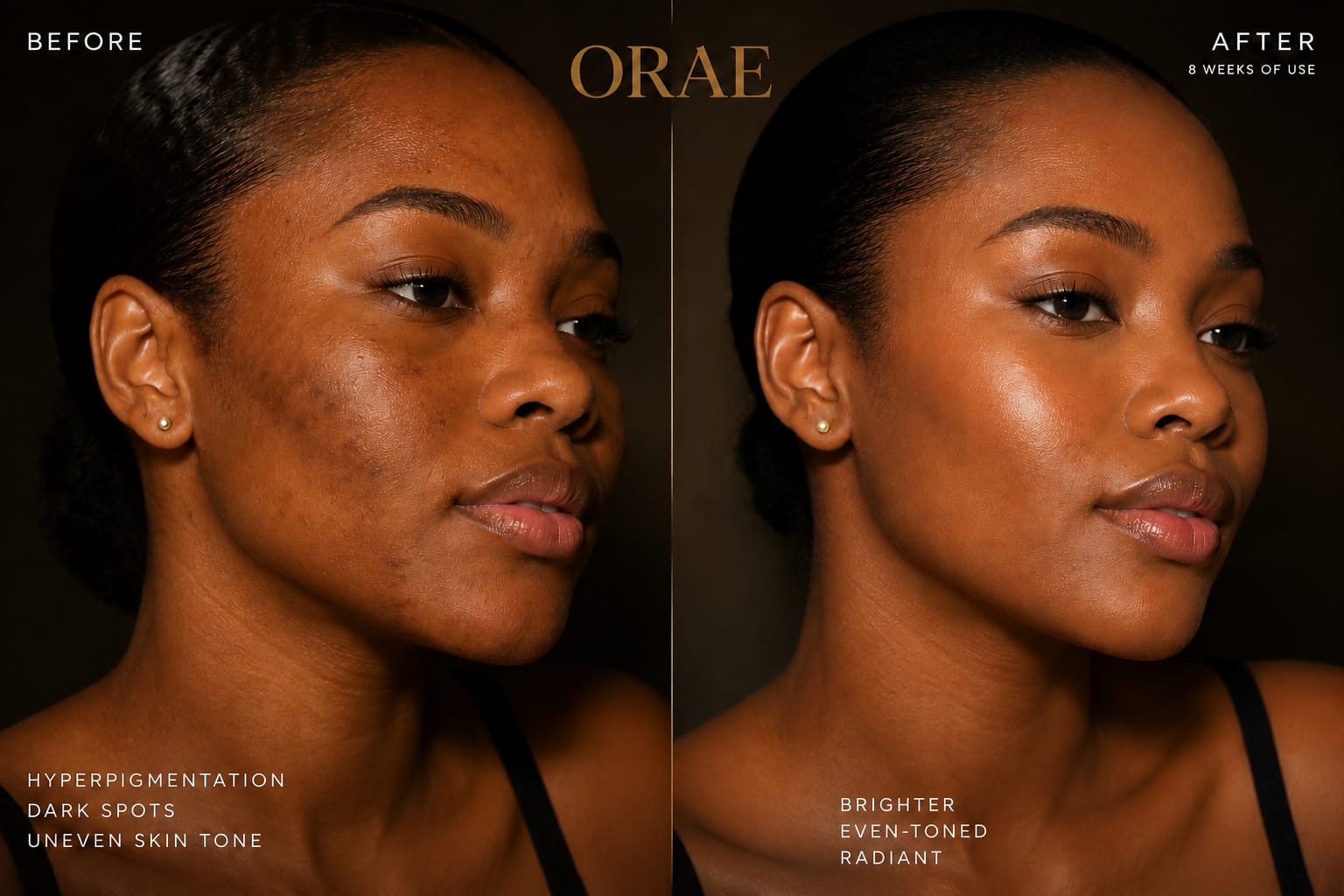 Before and after comparison after eight weeks of ORAE Melanin Glow Serum use, showing a brighter, more even complexion